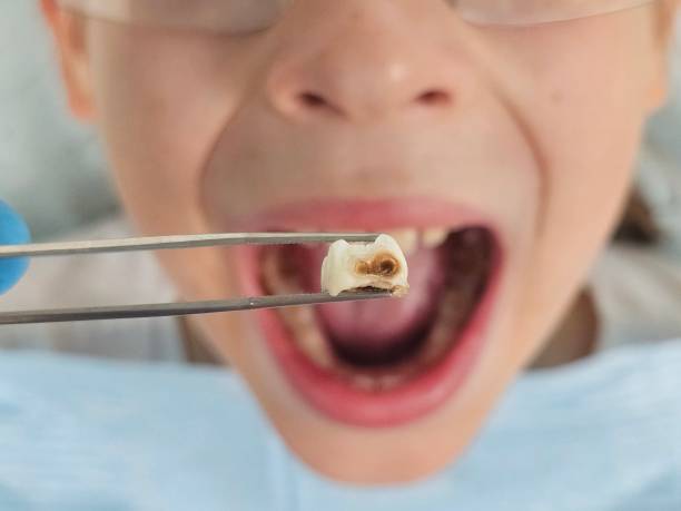 Best Weekend Emergency Dental Services in Hanover, OH