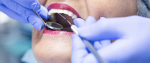 Best Emergency Cosmetic Dentistry (e.g., broken veneers) in Hanover, OH